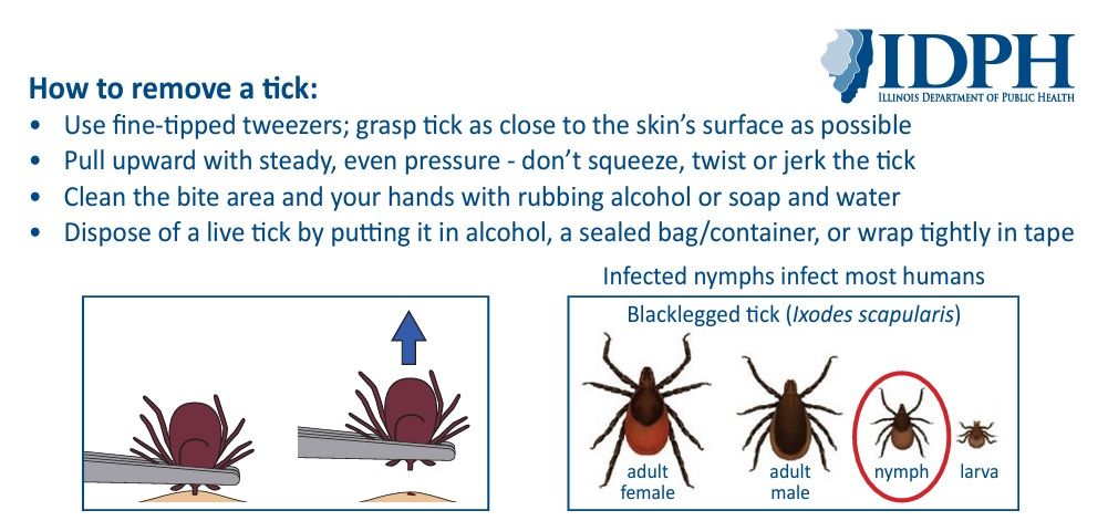 Tick graphic from IDPH on how to remove